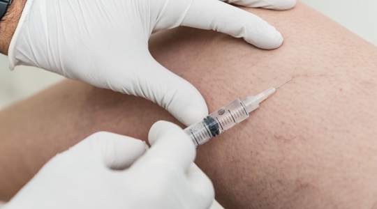 Woman receiving sclerotherapy treatment for spider veins on her legs at a medspa