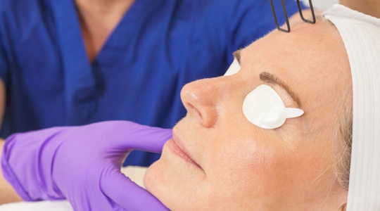 Woman receiving SmartXide CO2 laser treatment at a medspa