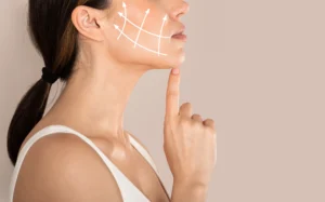 A side profile of a woman with contouring lines, illustrating the benefits and procedure steps from your guide to cheek fillers.