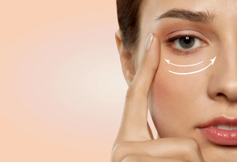 A woman undergoing a professional under-eye laser procedure to reduce dark circles and fine lines, showcasing the best under eye laser treatment.