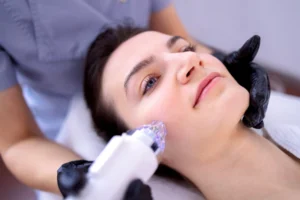 A woman undergoing RF microneedling treatment with a specialized device, enhancing collagen production for long-lasting skin rejuvenation.
